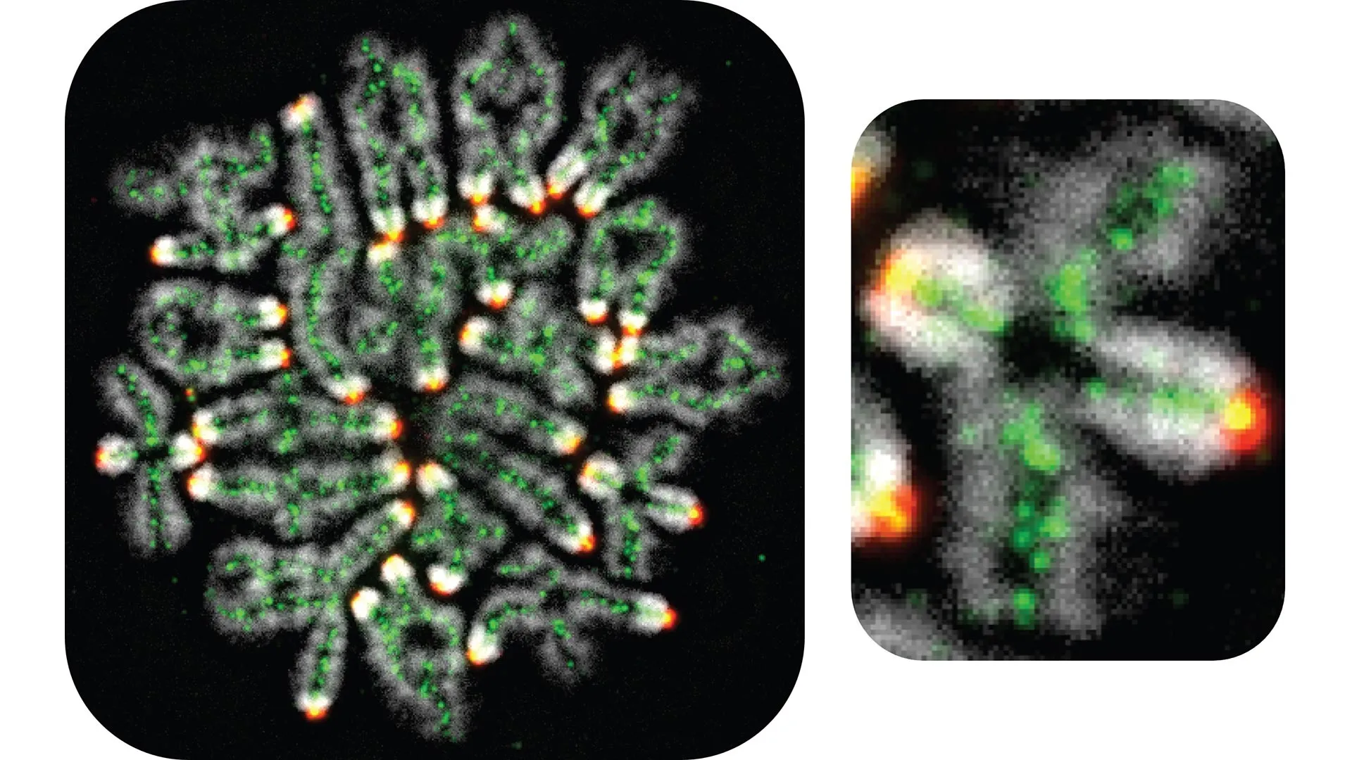 Miscarriages, down syndrome, and infertility all linked to this hidden DNA process